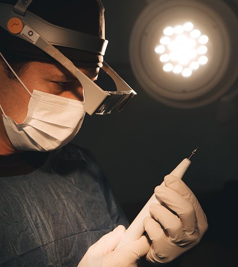 é a técnica mais moderna e precisa para transplante capilar